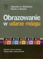 okładka książki - Obrazowanie w udarze mózgu