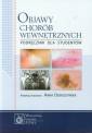 okładka książki - Objawy chorób wewnętrznych. Podręcznik