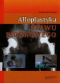 okładka książki - Alloplastyka stawu biodrowego