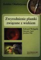 okładka książki - Zwyrodnienie plamki związane z