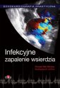 okładka książki - Echokardiografia. Praktyczna. Infekcyjne