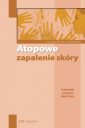 okładka książki - Atopowe zapalenie skóry