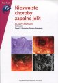 okładka książki - Nieswoiste choroby zapalne jelit