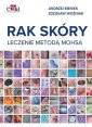 okładka książki - Rak skóry. Leczenie metodą Mohsa