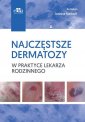 okładka książki - Najczęstsze dermatozy w praktyce