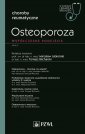 okładka książki - Osteoporoza. Współczesne podejście.