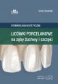 okładka książki - Licówki porcelanowe na zęby, żuchwy