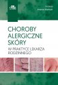 okładka książki - Choroby alergiczne skóry w praktyce