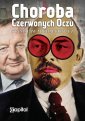 okładka książki - Choroba czerwonych oczu