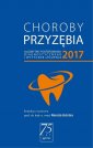 okładka książki - Choroby przyzębia 2017. algorytmy