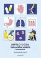 okładka książki - Amyloidoza łańcuchów lekkich. Kompendium