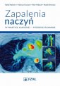 okładka książki - Zapalenia naczyń w praktyce klinicznej