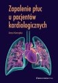 okładka książki - Zapalenie płuc u pacjentów kardiologicznych