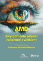 okłakda ebooka - AMD Zwyrodnienie plamki żółtej