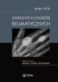 okłakda ebooka - Atlas RTG zapalnych chorób reumatycznych