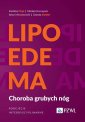 okłakda ebooka - Lipoedema. Choroba grubych nóg.