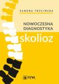 okłakda ebooka - Nowoczesna diagnostyka skolioz