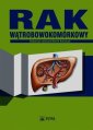 okłakda ebooka - Rak wątrobowokomórkowy
