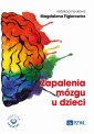 okłakda ebooka - Zapalenia mózgu u dzieci